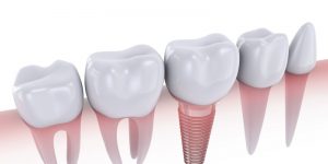 teeth health smile dentist