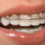 teeth, health, smile,dentist, dentalhealth, oralhealth