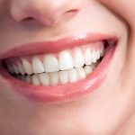 teeth, health, smile,dentist, dentalhealth, oralhealth